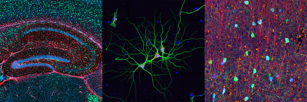 Department of Synaptic Plasticity