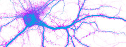 Distribution of the synaptic protein CamkIIalpha (magenta) within dendrites of a neuron (blue).