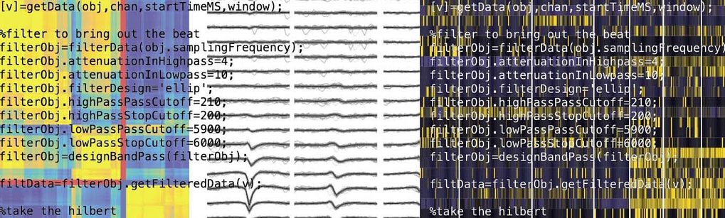 Software / Techniques