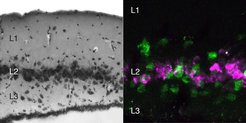 left: a snapshot of the turtle three-layered cortex and right: distinct types of neurons in the turtle dorsal cortex. The neurons are labeled with fluorescent in situ hybridization for two genes expressed in the two neuronal types.