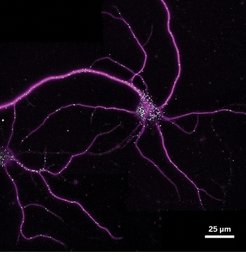 Granules filled with mRNA (white) zoom around neurons (purple) until they´re needed for memory formation (© Science).