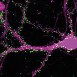 Hippocampal neuron