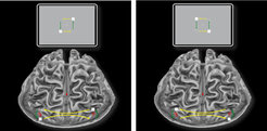 A motion quartet illusion of motion by jumping back and forth between two pairs of squares. The squares are processed in the opposite hemisphere of the brain.