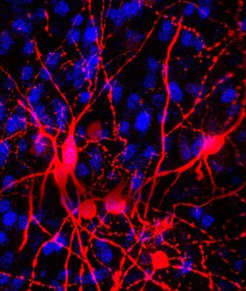 Max Planck Institute for Brain Research / V. Stempel