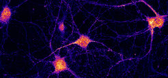 Lokalisierung des FERRY-Komplexes in Neuronen